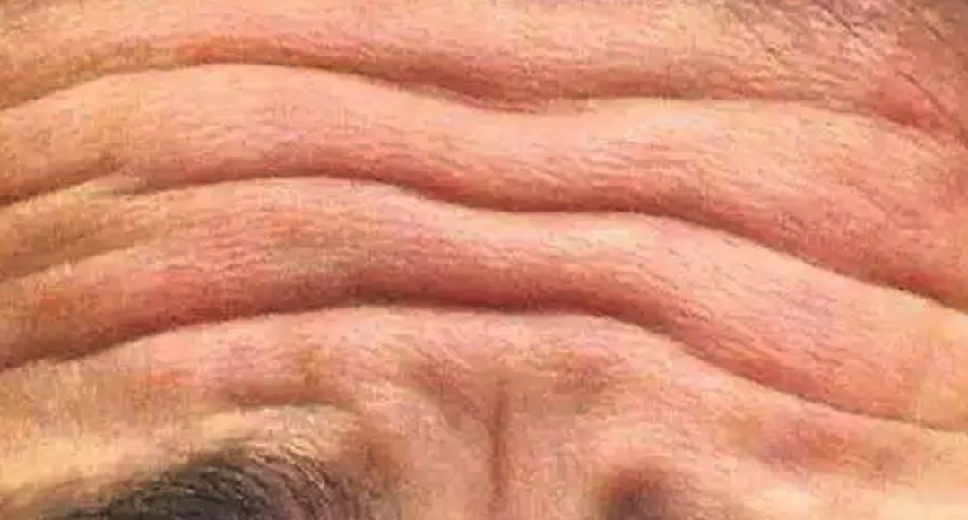 broken image